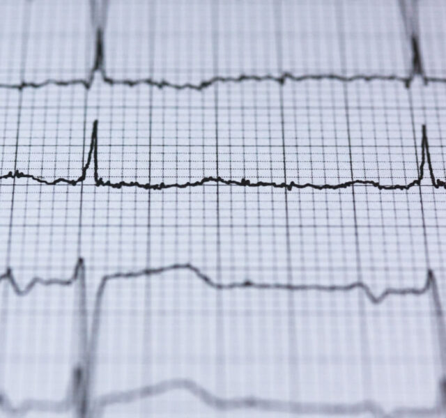 kardiologos larisa ilektrokardiografima ekg &bull; Portfolios &bull; Απόστολος Θ. Δήμος &bull; Ειδικός Καρδιολόγος Λάρισα