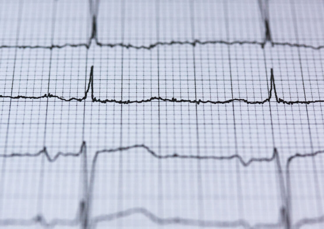 kardiologos larisa ilektrokardiografima ekg &bull; Portfolios &bull; Απόστολος Θ. Δήμος &bull; Ειδικός Καρδιολόγος Λάρισα